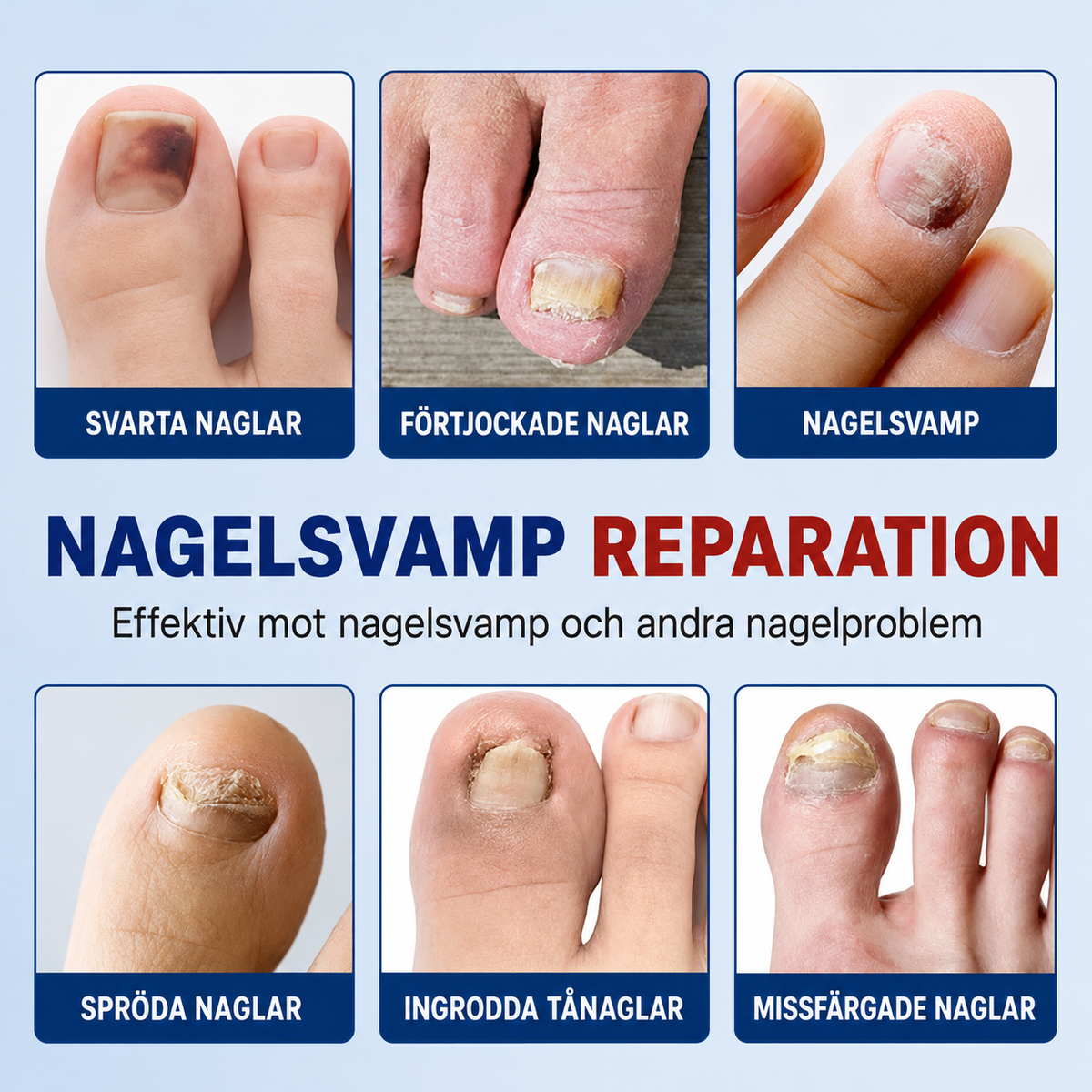 Nailfix - Svampplåster för nagelreparation