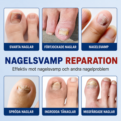 Nailfix - Svampplåster för nagelreparation