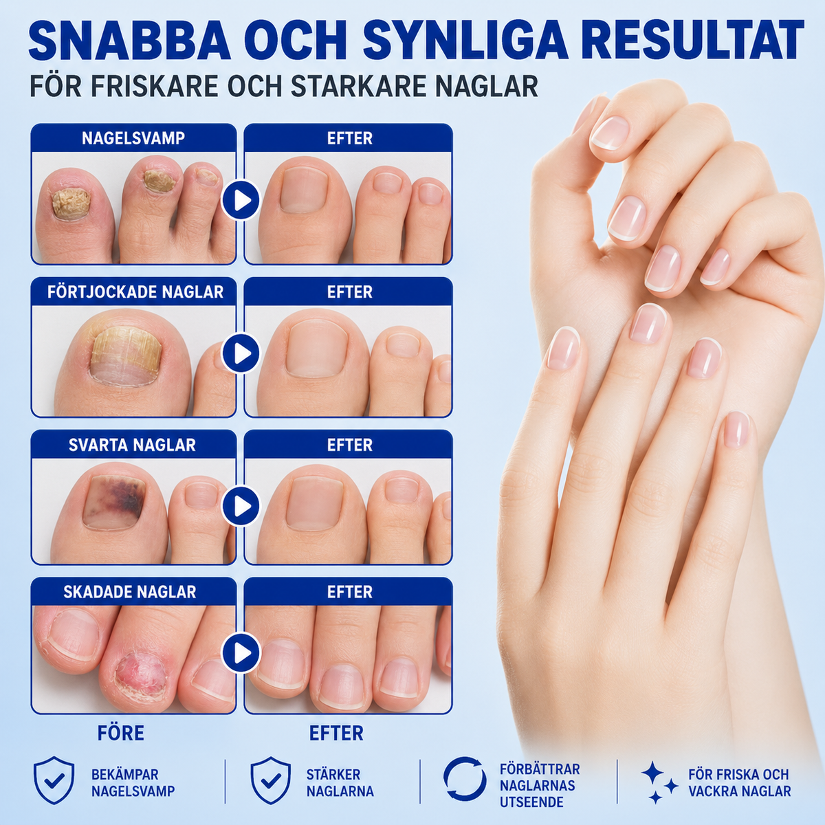Nailfix - Svampplåster för nagelreparation