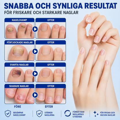 Nailfix - Svampplåster för nagelreparation